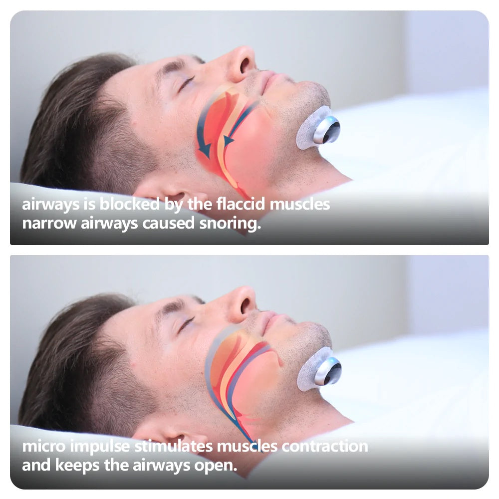 Snore Circle YA4200 Plus Electronic Muscle Stimulator